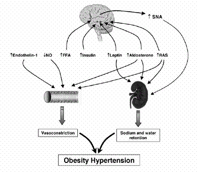 relazioni tra obesit e ipertensione